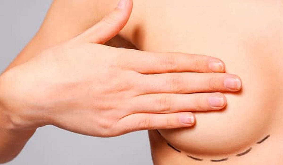 aumento de pecho precio